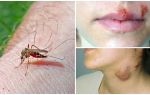 Kādas slimības cieš no odiem